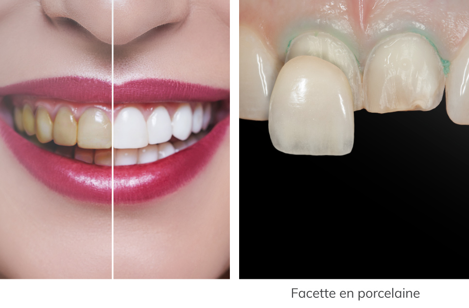Clinique-DDS-Photos-Services-Esthetique